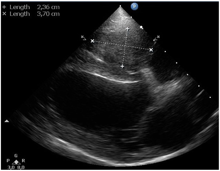 Figure 6
