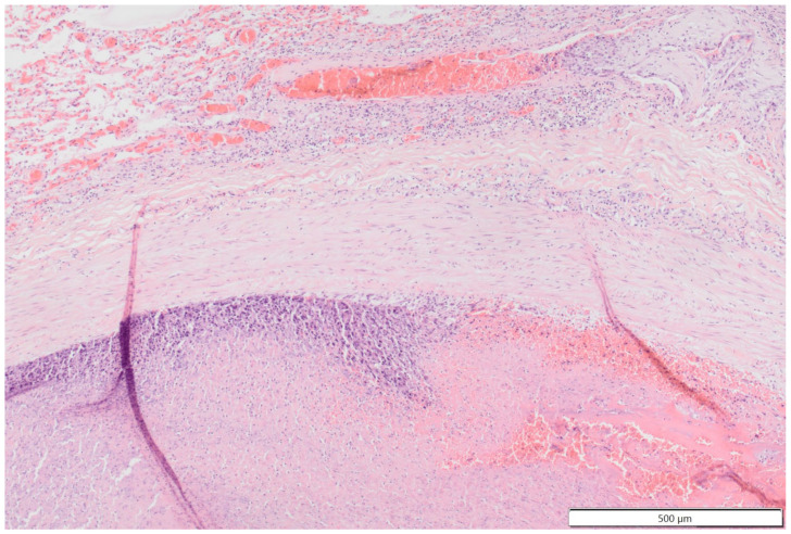 Figure 14