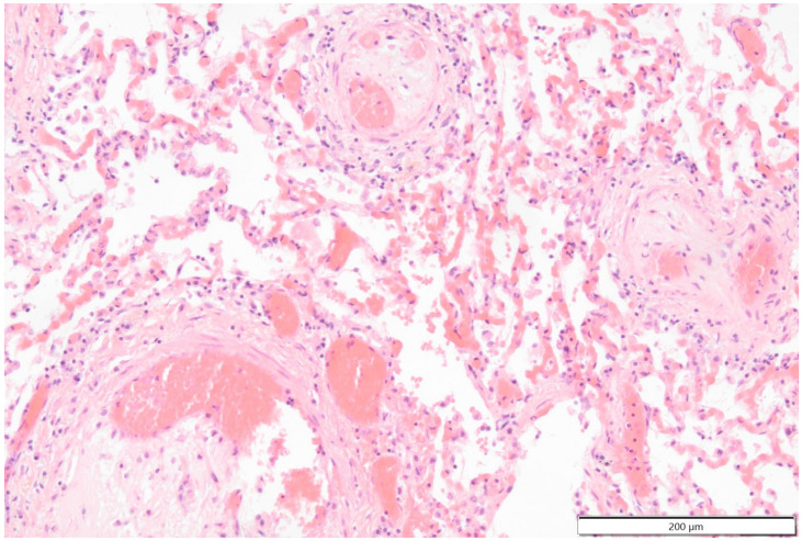 Figure 16