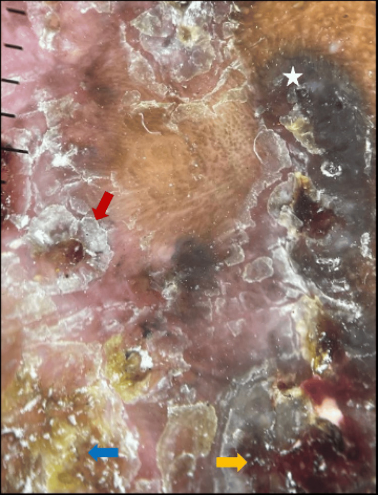 Figure 10