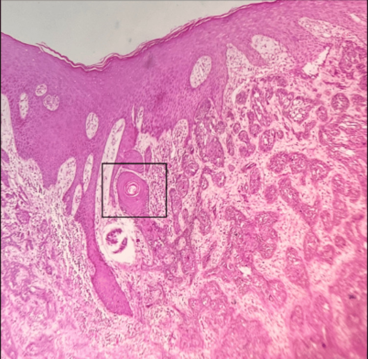 Figure 12