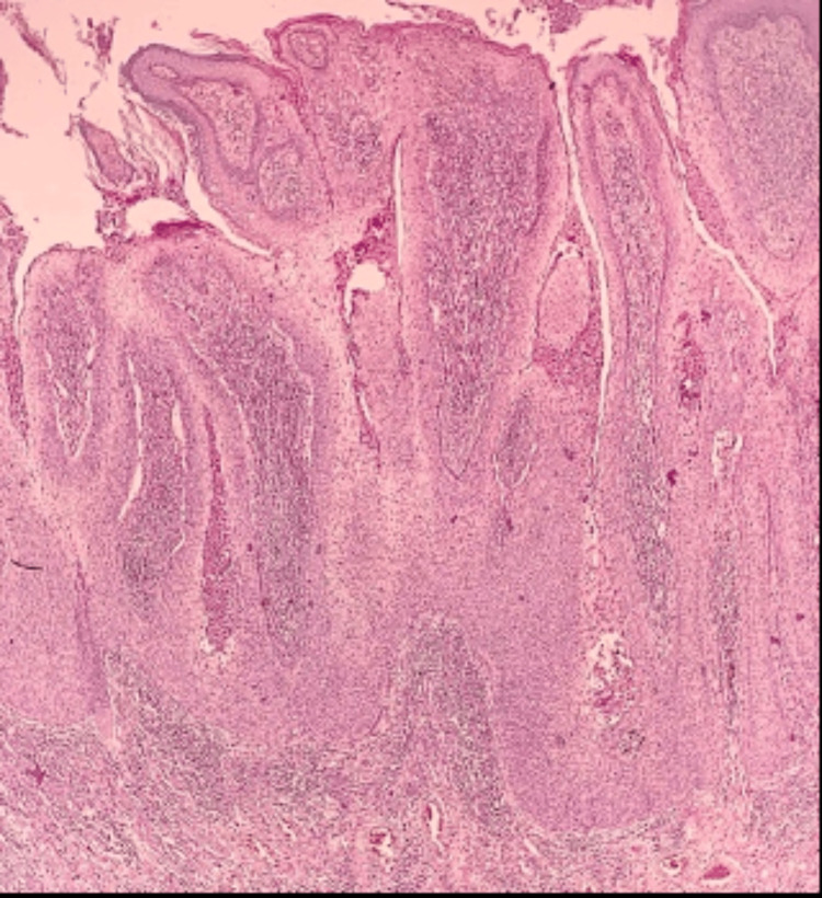 Figure 16