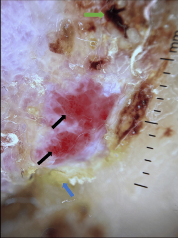 Figure 19