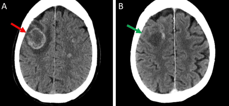 Figure 7