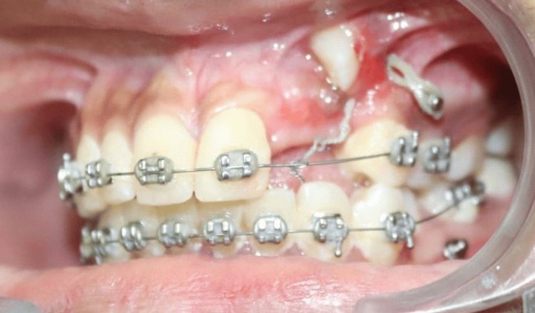 Figure 12