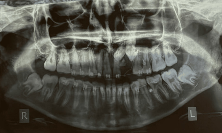 Figure 13