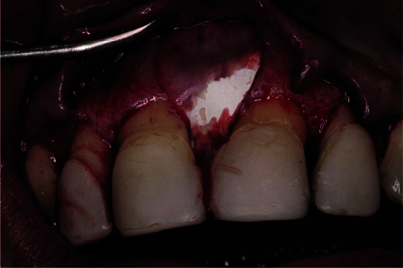 Figure 9