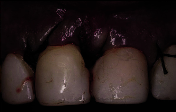 Figure 11