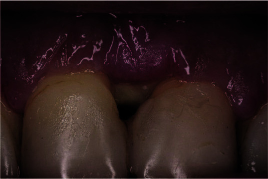 Figure 12