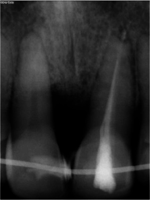 Figure 14