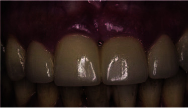 Figure 17