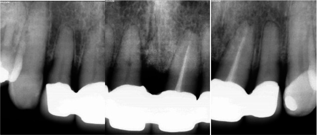 Figure 18
