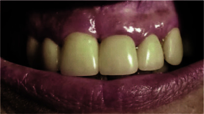Figure 19