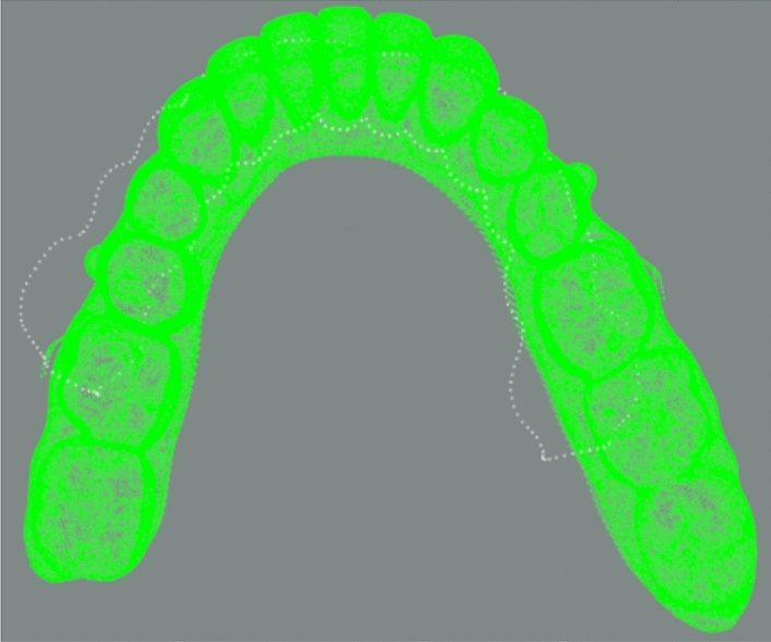 Figure 11