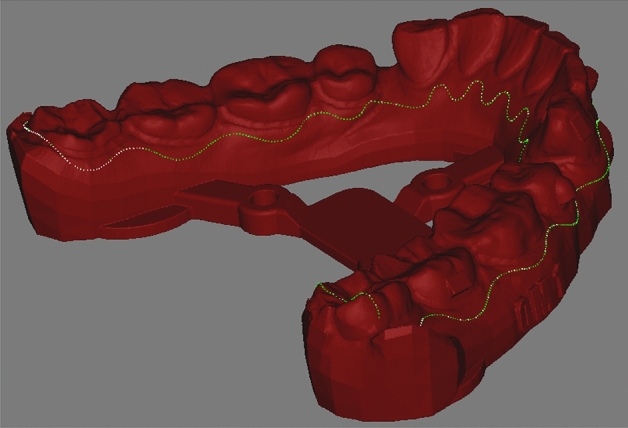 Figure 20