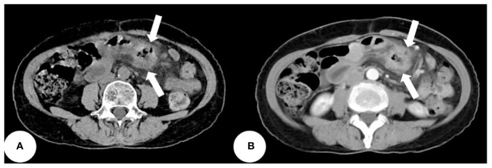 Figure 3
