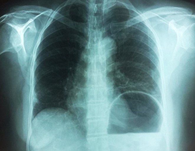 FIGURE 4