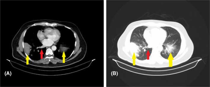 FIGURE 2