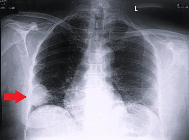 FIGURE 1