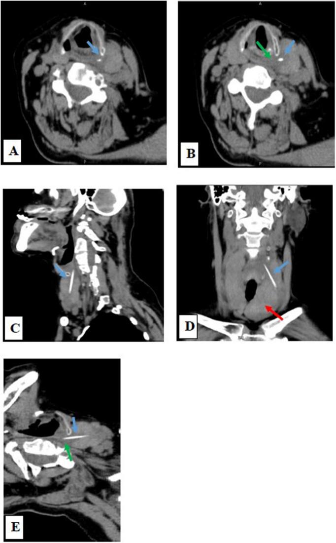 Figure 2