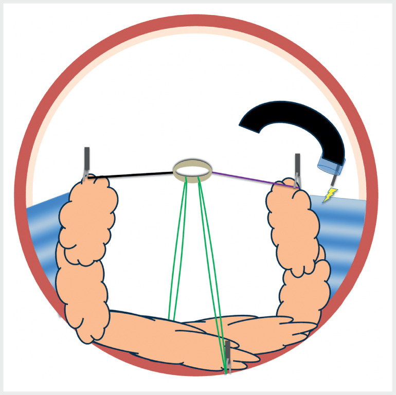 Fig. 2