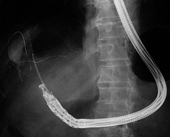 Fig. 3