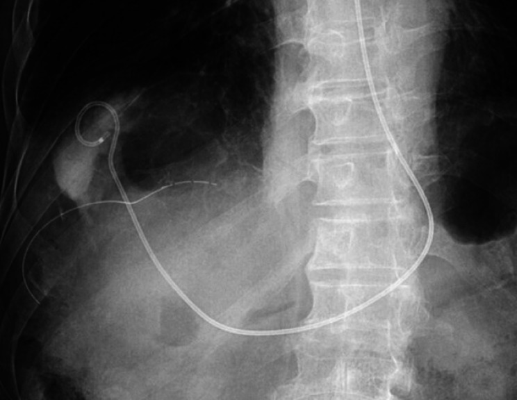Fig. 4