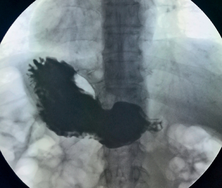 Fig. 2
