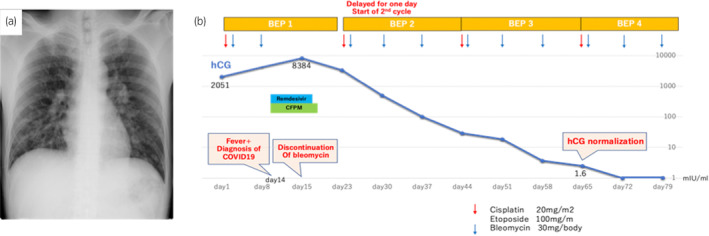 Fig. 2
