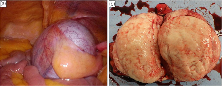 Fig. 2