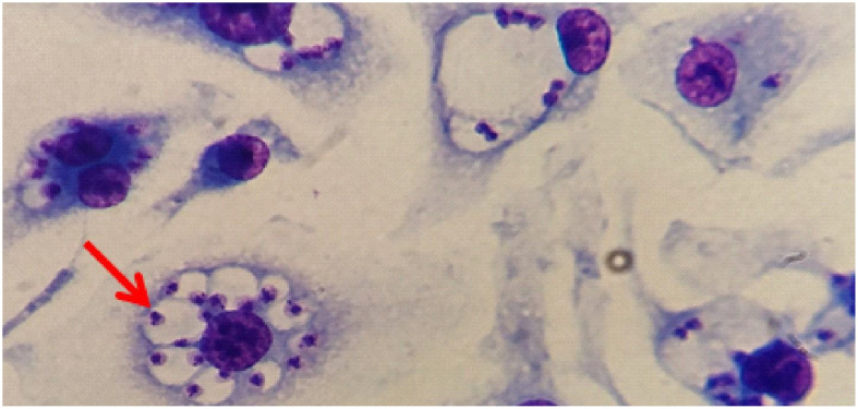 Figure 12