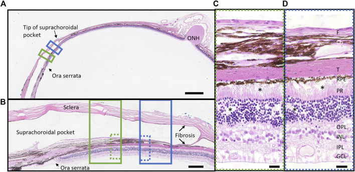 FIGURE 11