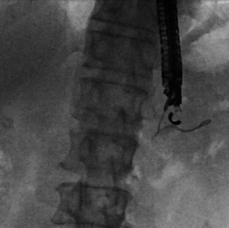 Fig. 1