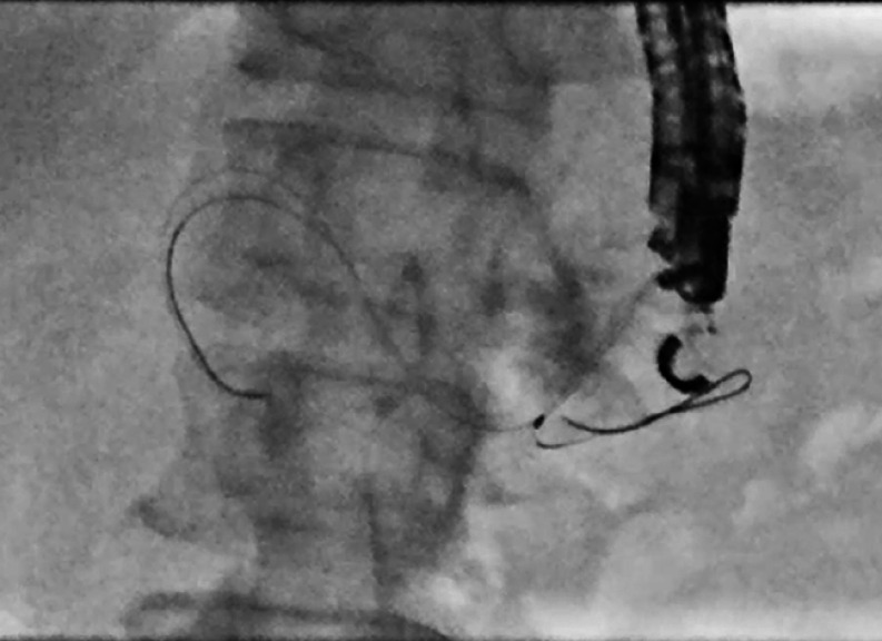 Fig. 2