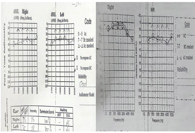 Fig. 5