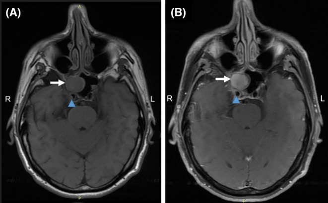 FIGURE 1