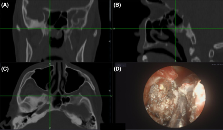 FIGURE 2