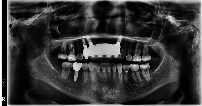 Figure 9