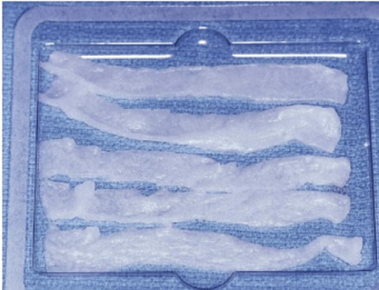 Figure 14