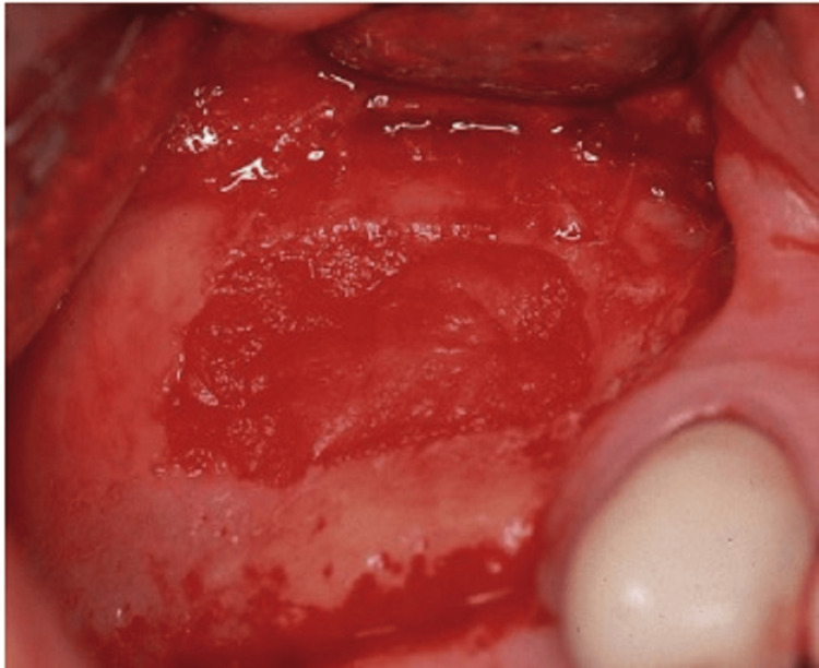 Figure 15