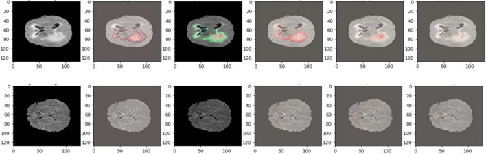 Figure 11
