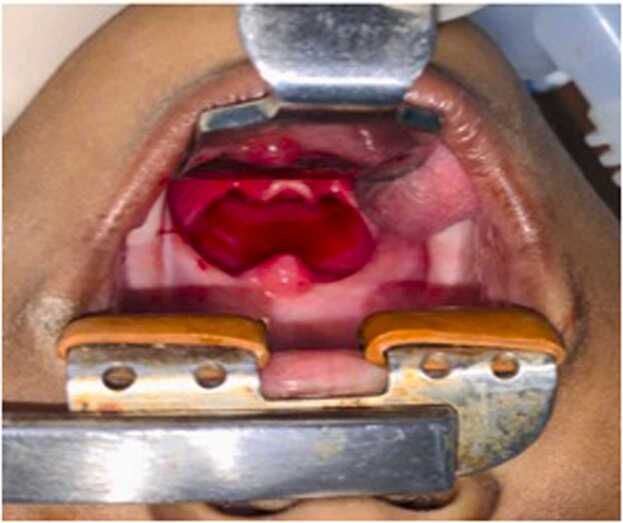 Figure 6