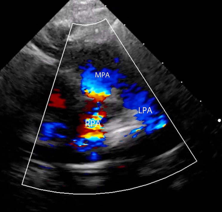 Figure 5