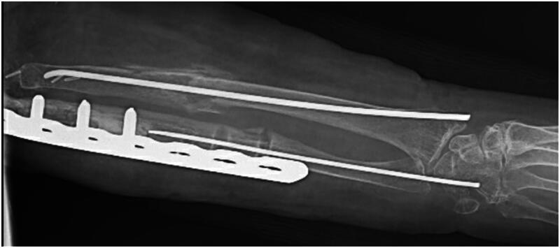 Figure 2