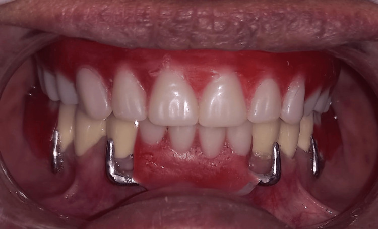 Figure 10