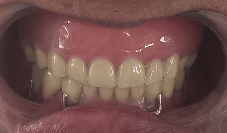 Figure 11