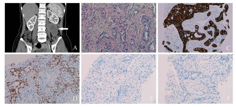 Figure 2