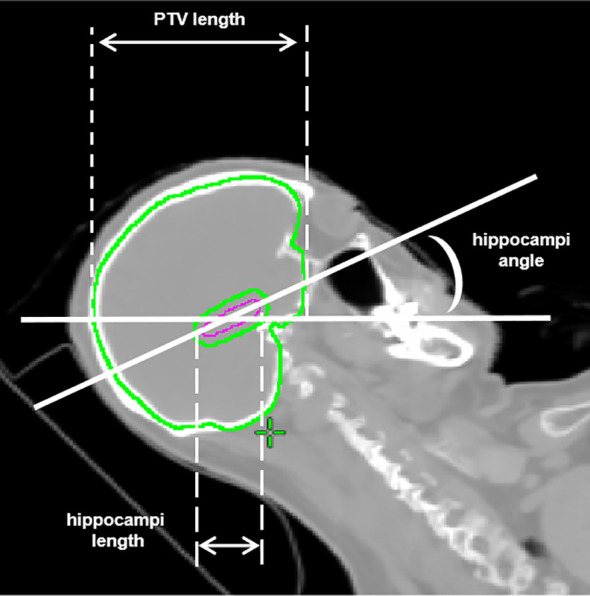 Figure 2