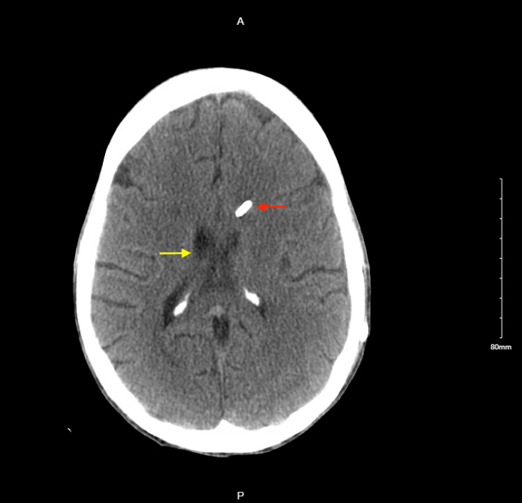 Figure 5