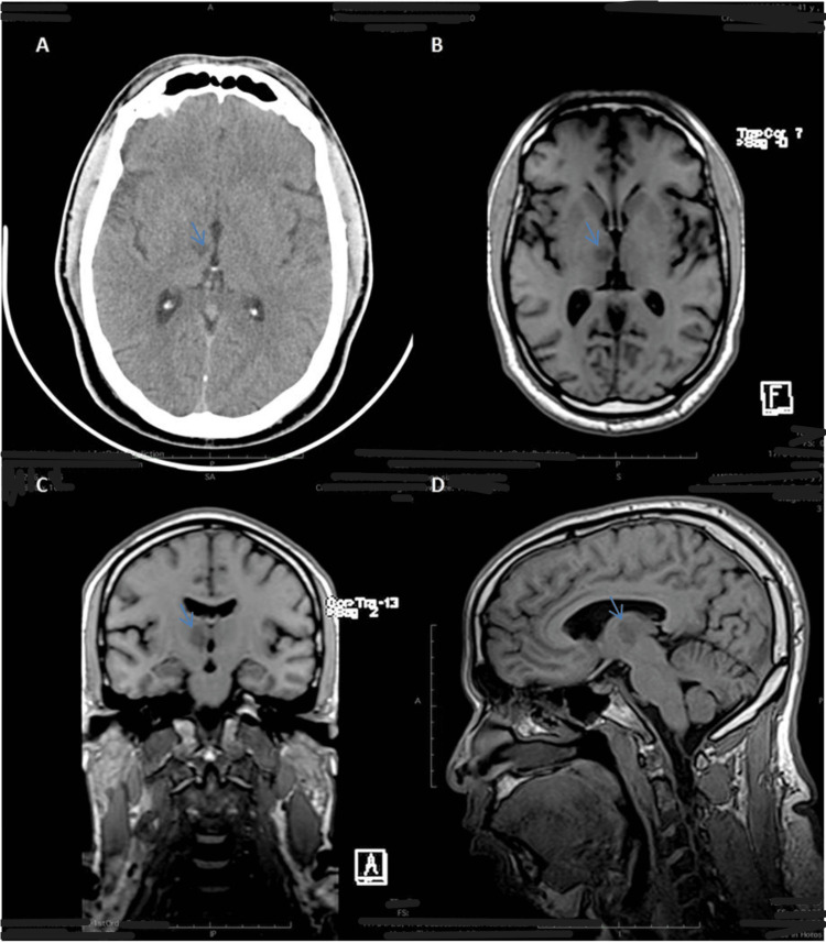 Figure 1